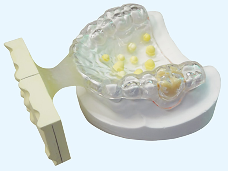 サージカルガイド