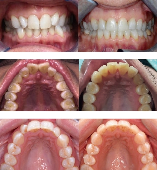ローテーションの改善