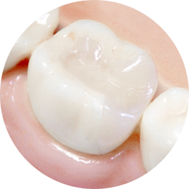 セラミック治療